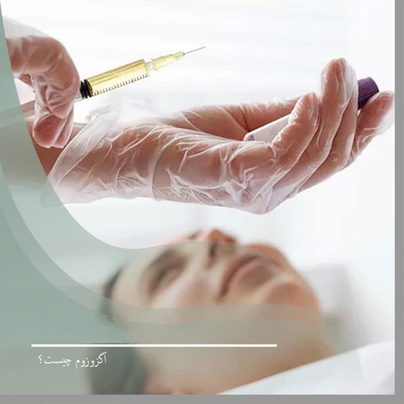 مرکز جوان‌سازی پوست شرق تهران با اگزوزوم