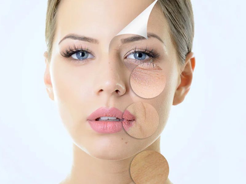 جوانسازی صورت 830